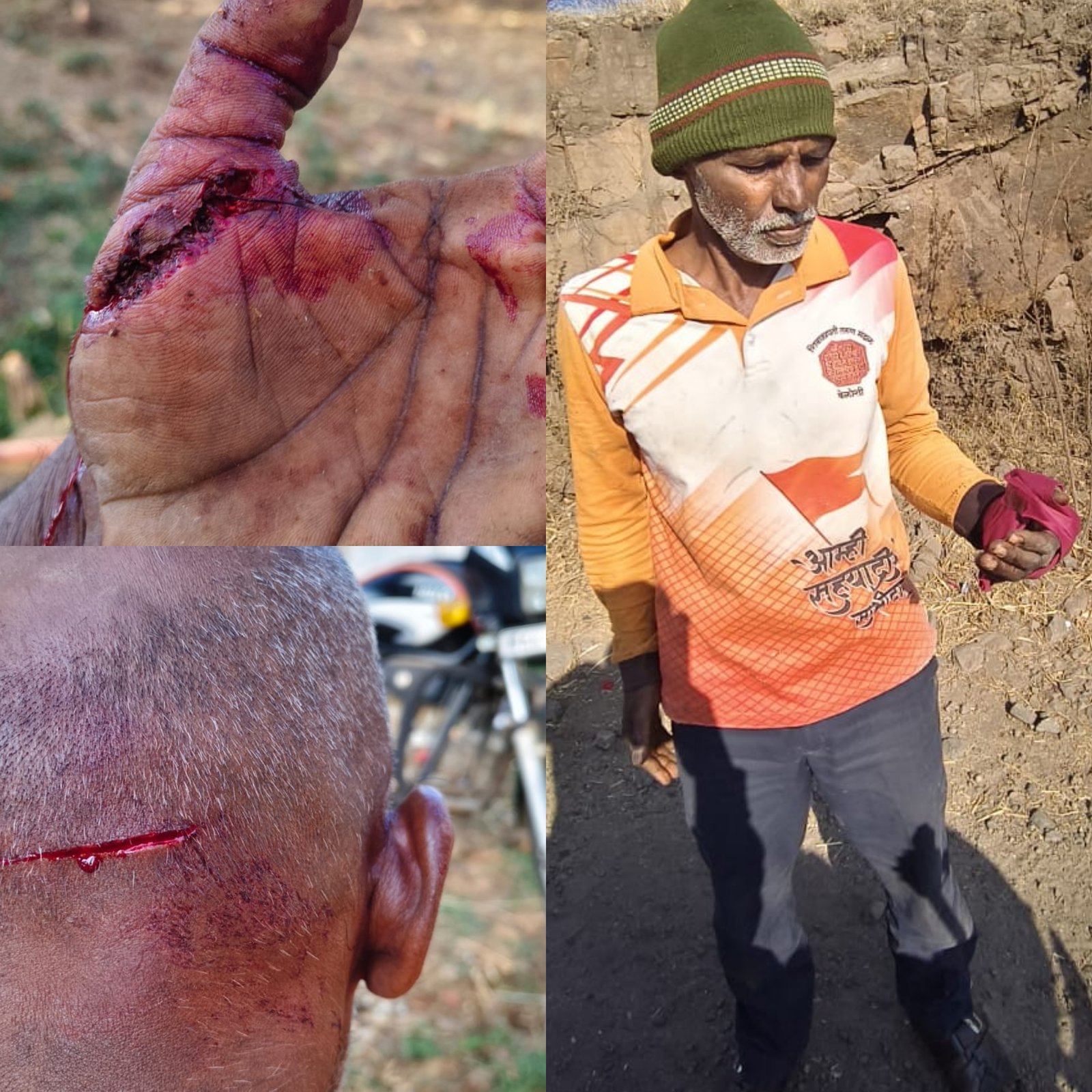 वेळोशी (ता. फलटण) येथे रानडुकराचा हल्ला; शेतकरी गंभीर जखमी